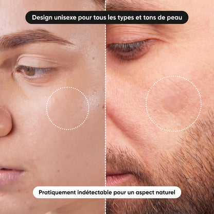 Patchs anti-acné hydrocolloïdes doux