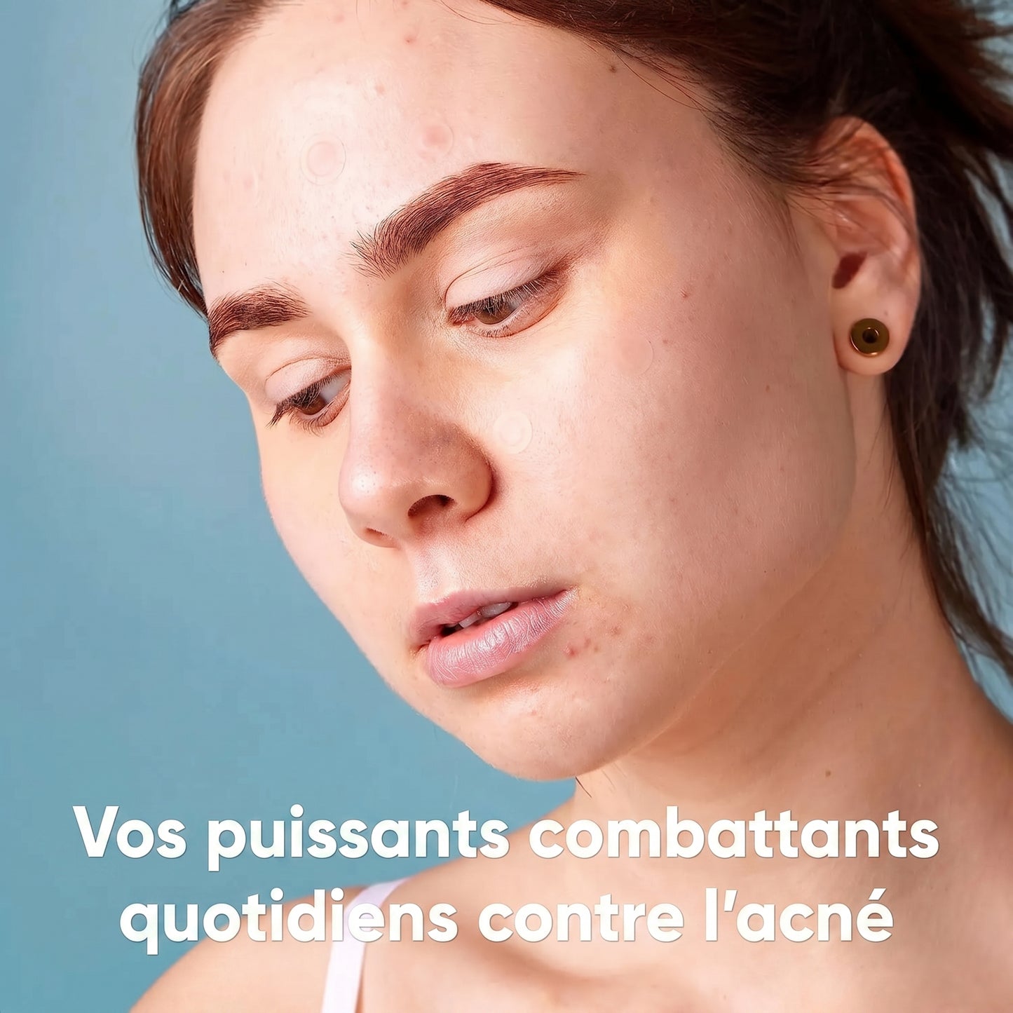 Patchs anti-acné hydrocolloïdes doux